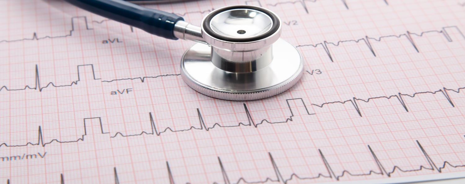 ACA Preventive Care provides less coverage than you may think EKG